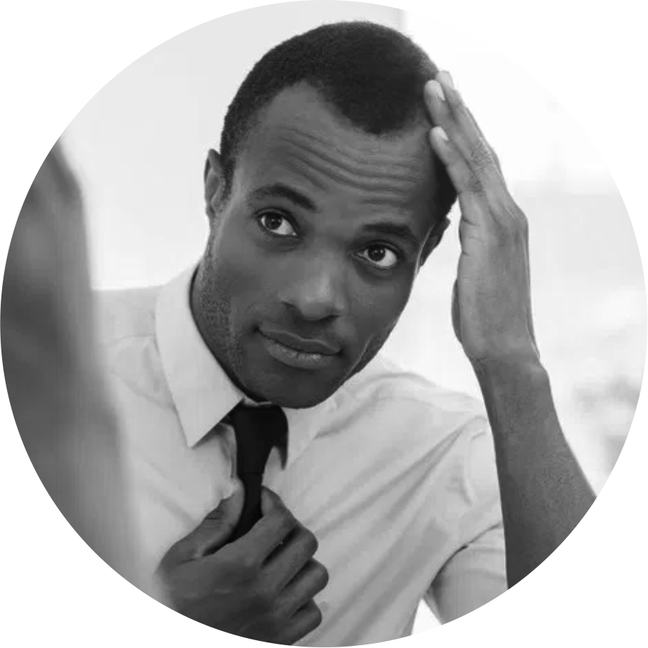 dermaroller hair loss 4