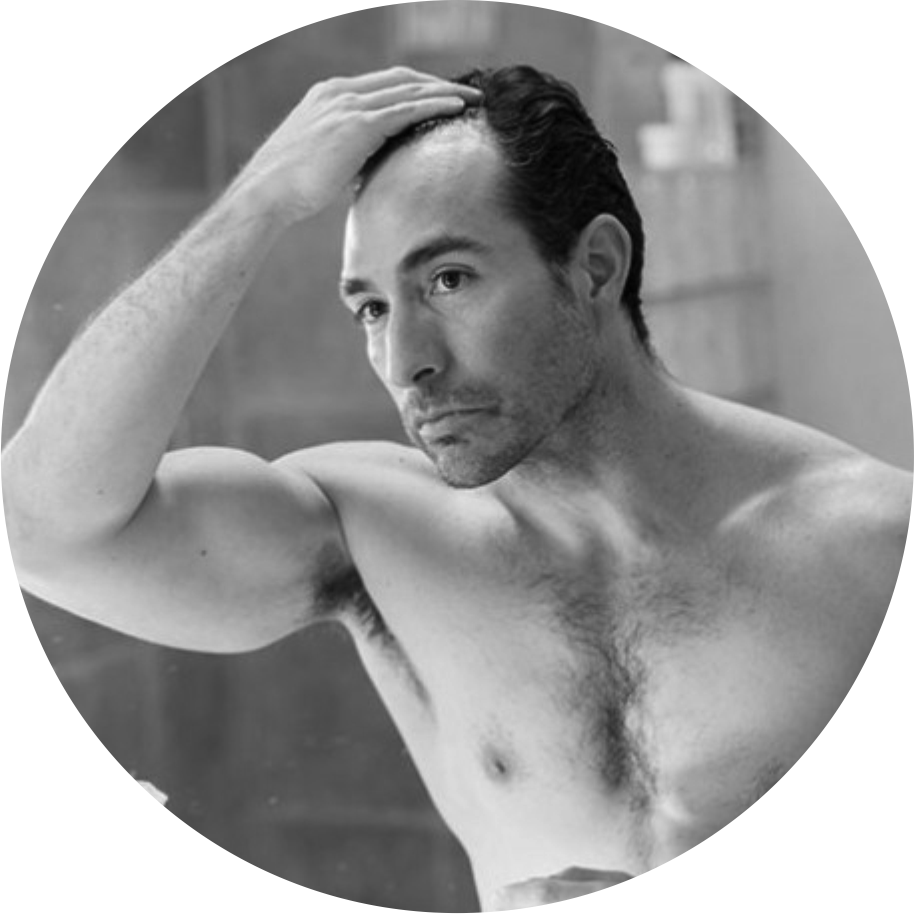 DermaRollers 6 dermaroller hair loss